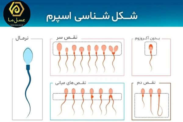 به چه حالتی اسپرم ضعیف گفته می‌شود؟